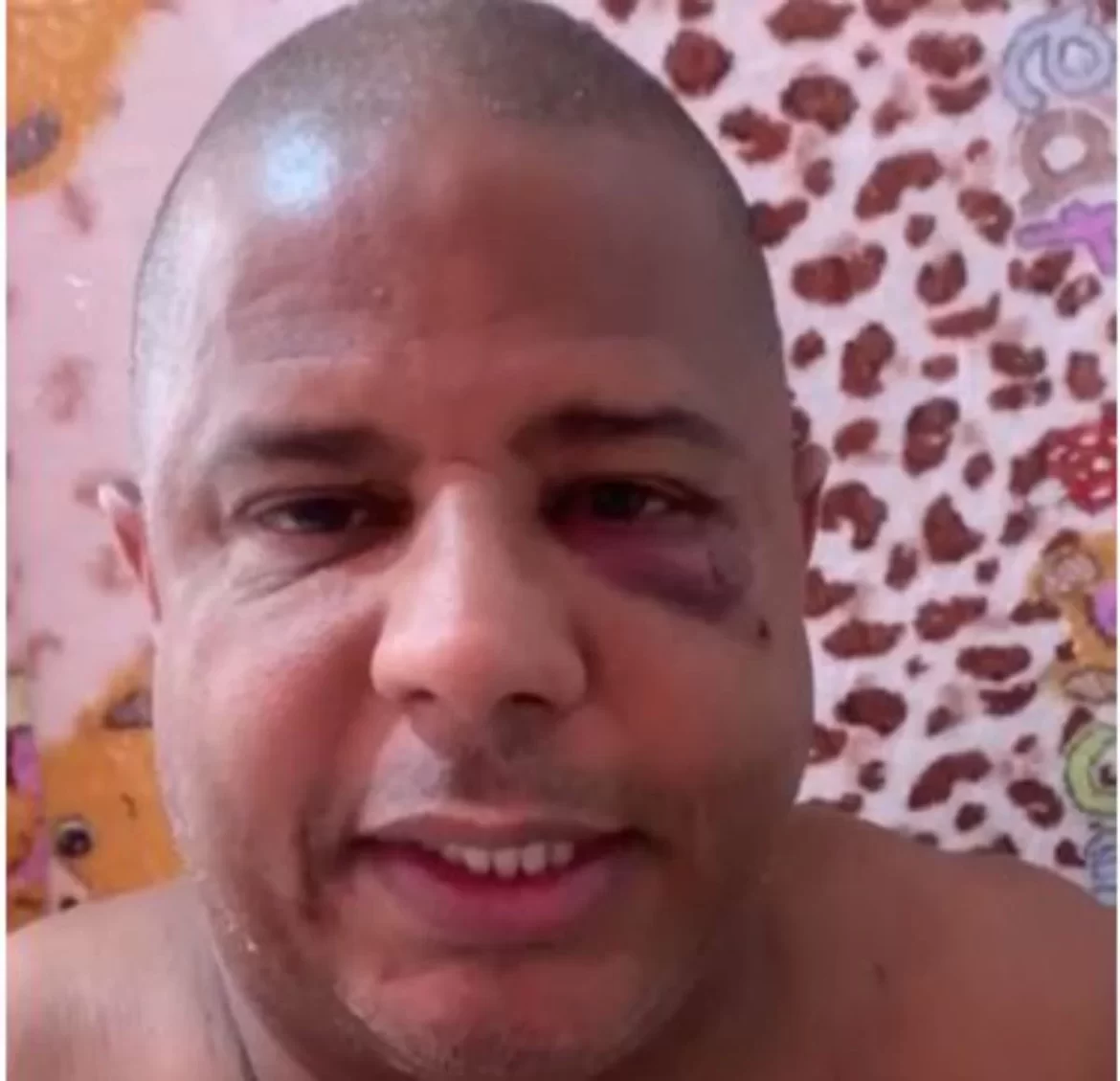 Com sinais de agressão, Marcelinho Carioca grava vídeo sobre sequestro